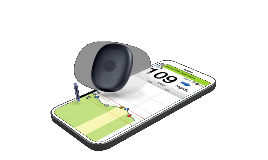 Continuous glucose monitor illustration